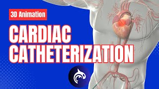 Cardiac Catheterization  3D Animation [upl. by Prestige597]