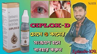 Ciplox D Eye Ear Drops❓Ciprofloxacin Dexamethasone Eye Ear Drops❓Ciplox D Drops [upl. by Eittak]