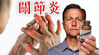 修復關節炎第一名維生素B3Niacinamide自然營養療法柏格醫生 Dr Berg [upl. by Neehsar]