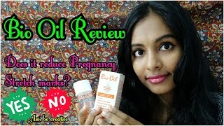 Bio Oil Review6 Ways to use Bio oil Does bio oil reduce pregnancy stretch marks amp uneven skin [upl. by Gilbye427]