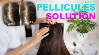 SOLUTION  Pellicules Dermite Séborrhéique Croûte de lait ✨ [upl. by Cire]