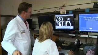 Stereotactic Radiation Therapy for Early Stage Lung Cancer [upl. by Gwyn]