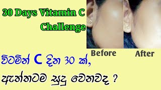 vitamin c for skin whitening and lightning l vitamin c tablet results l vitamin c sinhala [upl. by Fong]