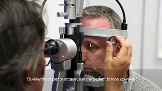 Slit Lamp setup and fundal assessment with a 90d lens [upl. by Etnaik]