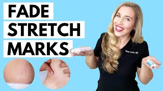 Fade Stretch Marks  Ingredients that WORK and the Science to Back it up [upl. by Chemaram]