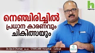 നെഞ്ചിരിച്ചിൽ പ്രധാന കാരണവും ചികിത്സയും  Acid reflux malayalam health tips [upl. by Nnyledam]