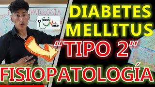 DIABETES MELLITUS TIPO 2 FISIOPATOLOGÍA  GuiaMed [upl. by Quintie]