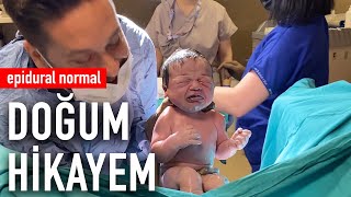 Doğum Hikayem  Epidural Normal Doğum [upl. by Staten]