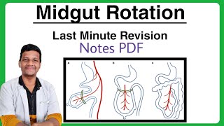 Midgut Rotation  Embryology  Anatomy  1st Year MBBS University Exam  Sudharshan R [upl. by Phila]