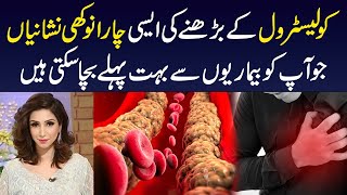 Cholesterol Level ko Kam Karne Ka Asan Tarika  How to Control Cholesterol Level  Dr Sahar Chawla [upl. by Talley]