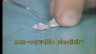 Introduction to Amalgam  Capmaster Tytin [upl. by Haimes]