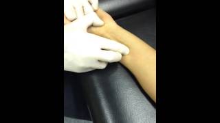 Flexor Pollicis Longus Dry Needling [upl. by Ivgnout864]