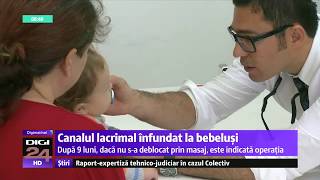 Interventie oculoplastica pentru canale lacrimale blocate [upl. by Aivatnwahs]