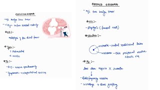 OSTEOCHONDROMA amp OSTEOID OSTEOMA NOTES ONE PAGE NOTES  ORTHOPAEDICS  4TH PROFF  MBBS [upl. by Dyrraj]