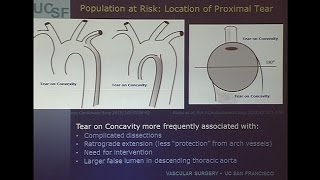 Which Acute Type B Dissection Patients Should Undergo TEVAR [upl. by Gasser]