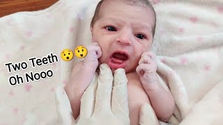 Special Newborn baby with Two Bottom Teeth just after birth cute special birth [upl. by Niwrehs]