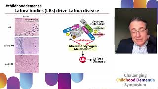 Preclinical treatments for Lafora disease  a childhood dementia driven by perturbed metabolism [upl. by Nerta483]