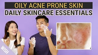 Best Daily Skincare Essentials for Oily Acne Prone Skin  WishTryLove [upl. by Ahsemal]