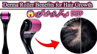 Derma roller 1mm for Hair RegrowthHow to use derma roller for hair growth [upl. by Rolf826]