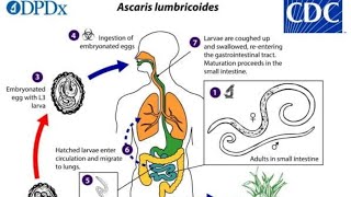 Ascaris lumbricoides habitat mode of infection pathogenecity lab diagnosis and prevention [upl. by Alecram]