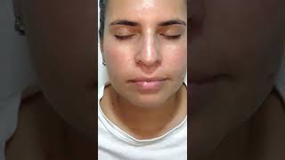 Mejor tratamiento para melasma para todo tipo de piel melasma hyperpigmentation skincare [upl. by Dorie]