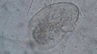 Ciliate sweeping up bacteria [upl. by Asirral]