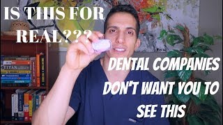 Does the teeth whitening light actually work [upl. by Efrem]