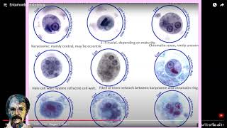 Diagnostic Parasitology Entamoeba histolyticaCourse [upl. by Aivatra]