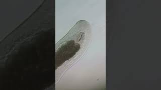 Flatworm Platyhelminthes under the microscope microscopy microscope science biology [upl. by Guod]