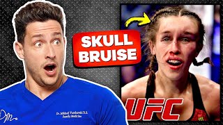 Doctor Reacts To Painful UFC MMA Injuries [upl. by Doykos937]