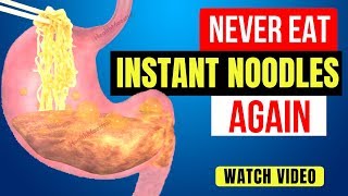 What Happens When You Eat Instant Noodles [upl. by Javier960]