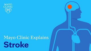 Mayo Clinic Explains Strokes [upl. by Griswold617]