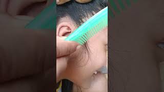 hair nomorelice hairstyle howtogetridofheadlice lice satisfying insects piercing hairlice [upl. by Tolmach]