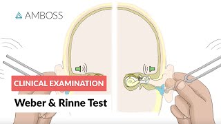 Weber and Rinne Test  Clinical Examination [upl. by Anirret561]