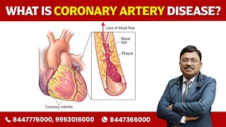 What is coronary artery disease  Dr Bimal Chhajer  saaol [upl. by Adalie]