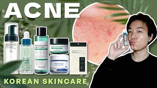 ACNE Treatment  6 Korean Skincare for Oily amp Acne Prone Skin 💦 🇰🇷 [upl. by Ecerahc853]