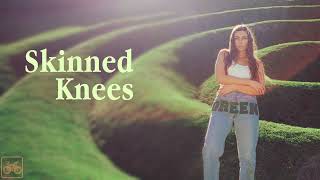 Emilee Moore  Skinned Knees Official Lyric Video [upl. by Ecnatsnok824]