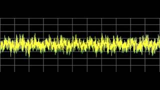 Diabetes 2  Rife Frequencies [upl. by Nylecaj272]