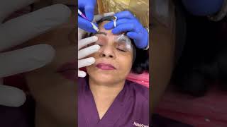 Eyebrow Microblading bestskincare bestskinclinic eyebrowtips eyebrowmicroblading [upl. by Pulchi]