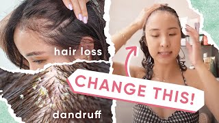 4 Reasons WHY Your Hair Loss amp Dandruff ISN’T Getting BETTER  5 TIPS [upl. by Mail983]