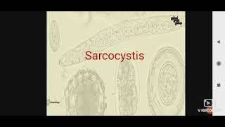 Sarcocystis para L3 [upl. by Oz271]