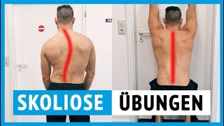 Skoliose Übungen vom Physiotherapeuten für zu Hause [upl. by Jemine]