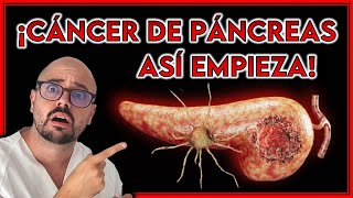 ASÍ empieza el CÁNCER DE PÁNCREAS y nadie lo sabe  ¡Estos son los PRIMEROS SÍNTOMAS [upl. by Greiner894]