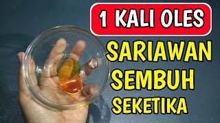 OBAT SARIAWAN PALING AMPUH CARA MENGATASI SARIAWAN SECARA ALAMI [upl. by Siroved]