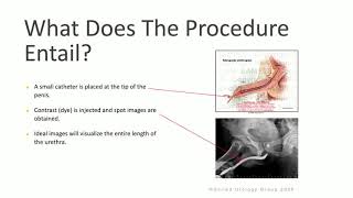 Retrograde Urethrogram amp voiding Cystourethrogram [upl. by Aziza911]