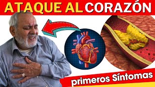 💔 SINTOMAS de INFARTO en Mujeres y Hombres ATAQUE AL CORAZÓN [upl. by Dave]