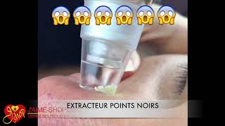 EXTRACTEUR POINTS NOIRS [upl. by Maison463]