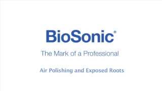 BioSonic Suvi Air Polishing and Exposed Roots [upl. by Nnyllatsyrc]