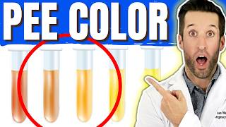 What Your Urine Says About Your Health 10 Signs You Shouldnt Ignore [upl. by Grete332]