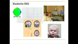 Monika Lewandowska  Dzień otwarty  o specjalizacji Neuropsychologia [upl. by Adiene]